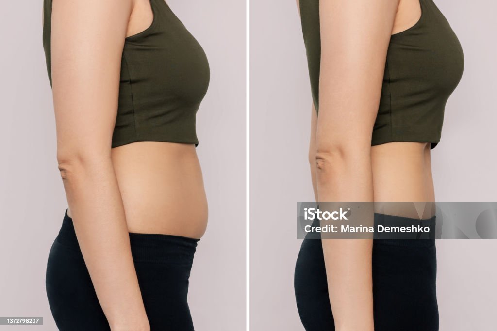 Before and after image showing reduced belly fat as a result of fitness motivation. Fitness Motivation Tips.